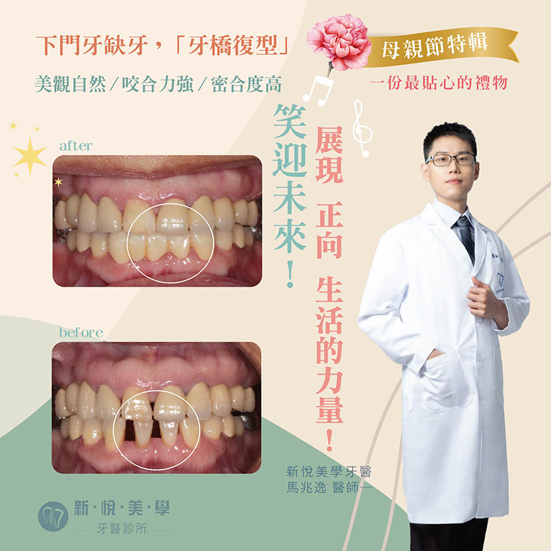 新悅美學牙醫診所的案例分享圖片
